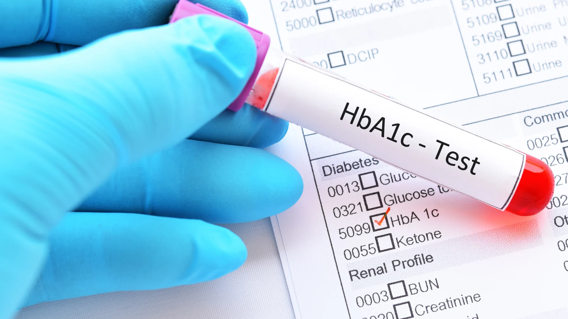 HbA1c Test